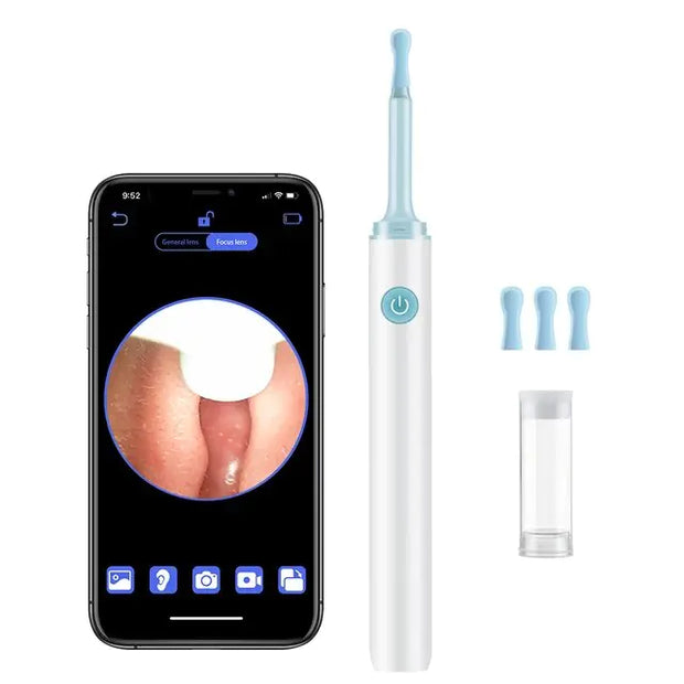 Ear Cleaner, Smart VisualSmart Visual Ear Cleaner - Premium  from Nobles Store - Just $42.70! Shop now at Nobles Store